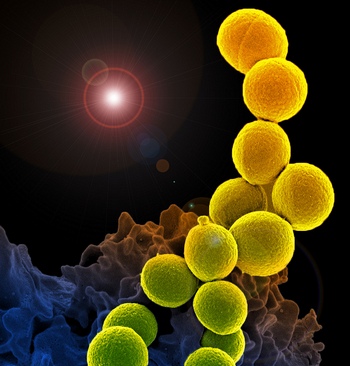 Метициллин-устойчивый золотистый стафилококк. Новый тип антибиотика способен подавлять рост стафилококковой инфекции и не вредит тканям организма. Фото: NIAID/flickr.com