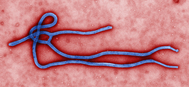 Вірус Ебола. Фото: CDC Global/Flickr.com