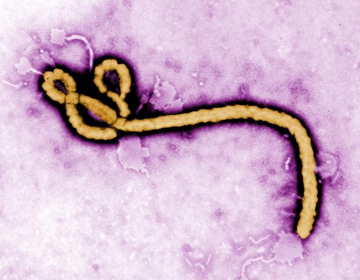 Вірус Еболи під збільшенням. Ілюстрація: CDC/Frederick A. Murphy