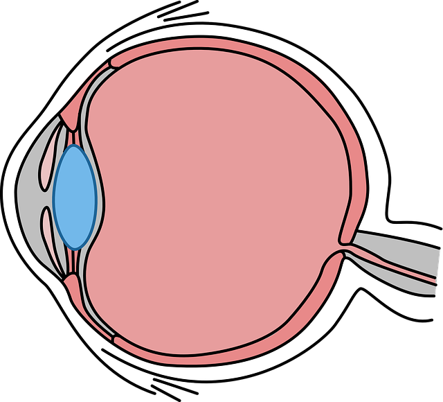 катаракта
