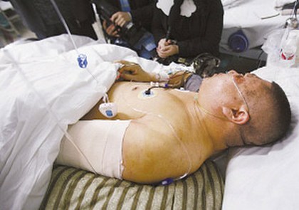 Представитель Всекитайского собрания народных представителей г.Чаньчунь Чжан Чжичун пострадал от рук полицейских. Фото epochtimes.com