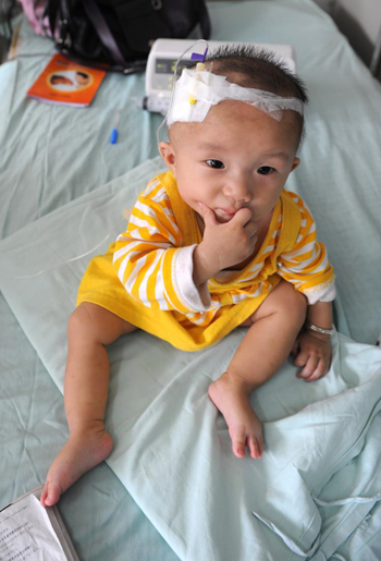Дитина, що страждає від утворених ниркових каменів після вживання отруєного молока, отримає медичну допомогу в дитячій лікарні Ченду, 22 вересня 2008 року, м. Ченду провінції Сичуань. Фото: China Photos/Getty Images