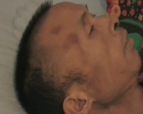 На голове г-на Хуана был след от удара тяжёлым предметом. Фото с minghui.org