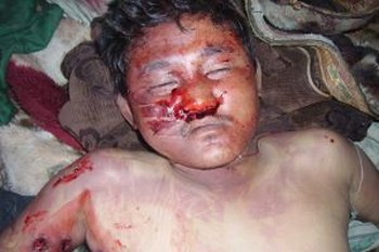 Житель Тибета, убитый китайскими властями. На теле обнаружено три пулевых ранения. Фото: Tibet Solidarity Committee