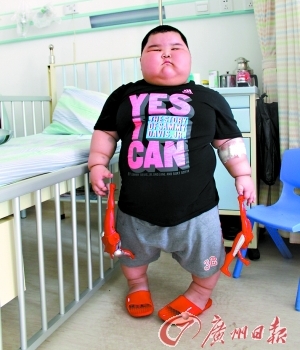 Трирічний хлопчик важить 60 кг. Фото: kanzhongguo.com