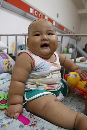 Простудний вірус може сприяти дитячому ожирінню. Фото: Afp/getty Images