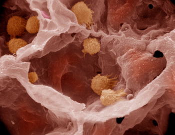 Лейкоциты в поисках посторонних частиц в альвеолах легких. Фото: Dr. Kessel & Dr. Kardon/Tissues & Organs/Getty Images