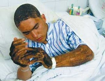 Ли Мин - единственный оставшийся в живых после нападения пчёл, находится на лечении в больнице. Фото с epochtimes.com