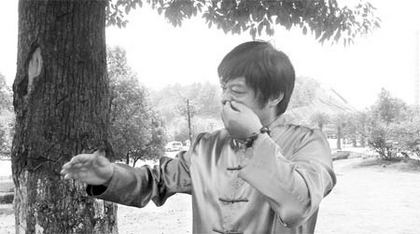 Юй Цзяньхуэй извлекает из ноздри иголки. Фото с secretchina.com