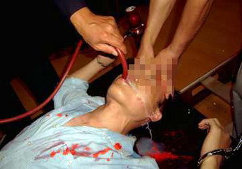 Насильницьке годування. Тематичне фото з epochtimes.com