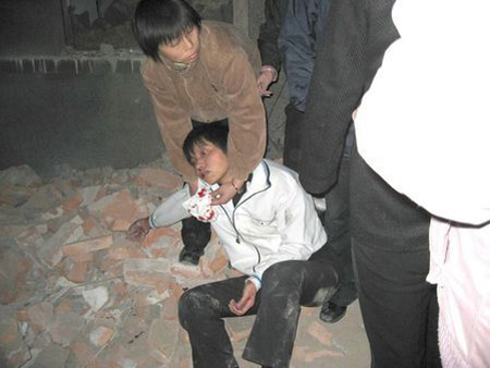 Ця молода черниця в листопаді 2005 стала жертвою бандитської групи, керованої владою, яка увірвалася в католицьку церкву міста Сіань, провінції Шаньсі і так побила 16 черниць, що вони потрапили до лікарні. Фото: China Aid