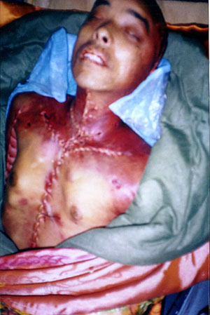 Ван Бинь (Wang Bin), 44-летний практикующий Фалуньгун из провинции Хэйлунцзян, был безжалостно избит до смерти Фэн Си и другими полицейскими (Feng Xi ) в мужском трудовом лагере  Дацин 24 сентября 2000 года. После этого его сердце и мозг были удалены, а о