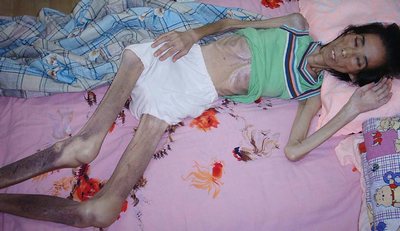 Последовательница Фалуньгун Жэнь Шуде, которая была доведена до истощения рабским трудом и пытками в трудовом лагере Китая. Была убита в 2004 г. после двух лет заключения. Фото: faluninfo.ru