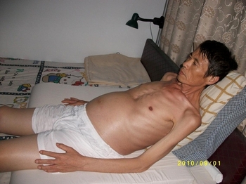 Чжан Юньбин после заключения в тюрьме так и не смог восстановить здоровье. Фото с epochtimes.com