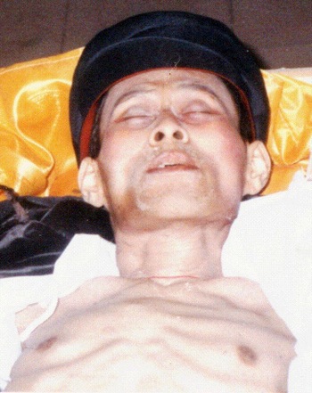Ян Сяоцзе, замученный пытками. Фото с minghui.org