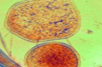 ARMAN могут быть паразитами, их размер 200-400 нанометров. Фото: iscience.ru