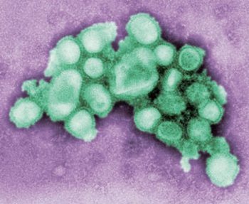 Вірус грипу H1N1. Фото: AFP