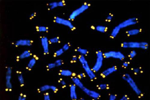 Пофарбовані хромосоми людини (сині) та їх теломери (жовті). Фото: vzglyadzagran.ru/news