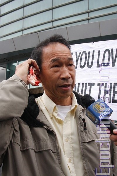 Пан Юй Венчжун розповідає репортерам про здійснений на нього напад. Фото: Dayin Chen/ The Epoch Times