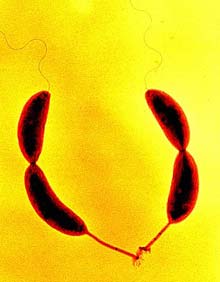 Фиксатор: Caulobacter crescentus прикрепляется к твердым предметам своими ножками и фиксатором (внизу).