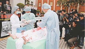 Демонстрація видаляння органів у живих практикуючих Фалуньгун, що відбувається сьогодні в Китаї. Фото: Велика Епоха