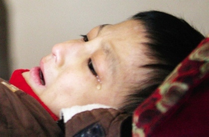Хлопчик ніколи не плакав. Того дня, коли до них прийшов кореспондент, батьки перший раз побачили в куточку ока дитини сльозу. Фото з epochtimes.com