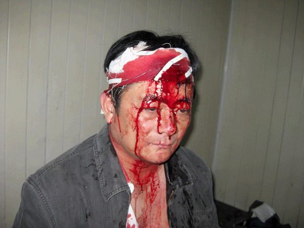 Один из пострадавших во время стычки крестьян. Фото с epochtimes.com