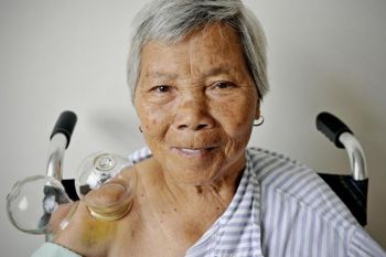 Літня жінка під час застосування техніки традиційної китайської медицини, відомої як 'кровопускання', в народному центрі здоров'я в Шанхаї. Фото: Філіппе Лопез/AFP/Getty Images