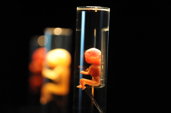 19-тижневий людський ембріон. Фото: ATTILA KISBENEDEK/AFP/Getty Images