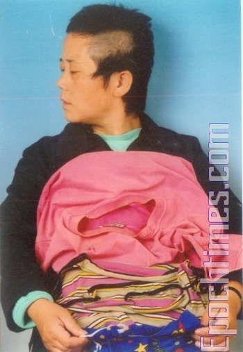У г-жи Чжу Гуйчин в трудовом лагере сбрили клок волос. Фото: The Epoch Times