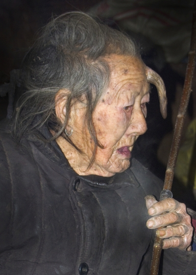 У столетней китаянки вырос длинный рог. Фото с epochtimes.com