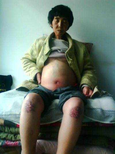 Сунь Фуди після звільнення з виправного табору. Квітень 2010 р.