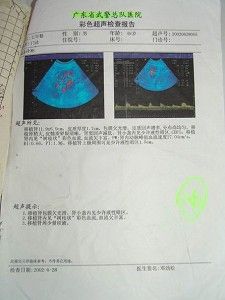 28 июня 2002 года Ван Няньвэнь получил первый ультразвуковой анализ в Главном госпитале военной милиции. Фото: The Epoch Times