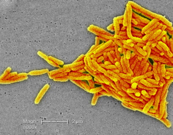 Після ретельного розслідування було встановлено, що причиною смерті легіонерів стала бактерія роду Legionella. Фото: Kallista Images / Getty Images