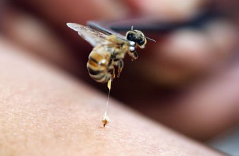 Первая помощь при укусе различных видов насекомых. Фото: Dimas Ardian/Getty Images