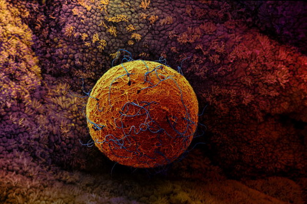 Множество сперматозоидов способно достигнуть яйцеклетки. Фото: Dr. David Phillips/Getty Images
