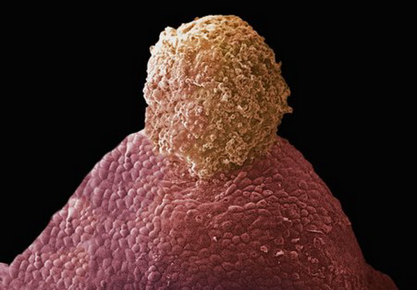 Овуляция яйцеклетки (выход из яичников) происходит приблизительно один раз в месяц. Фото: Yorgos Nikas/Getty Images