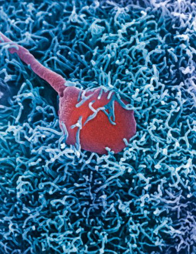 Однако только после того как один из них осуществит акросомальную реакцию и внедрит свой генетический материал, у остальных сперматозоидов не будет возможности проникнуть внутрь. Фото: Dr. David Phillips/Getty Images