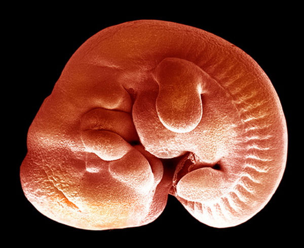 Формирующийся зародыш. Фото: Dr. David Phillips/Getty Images