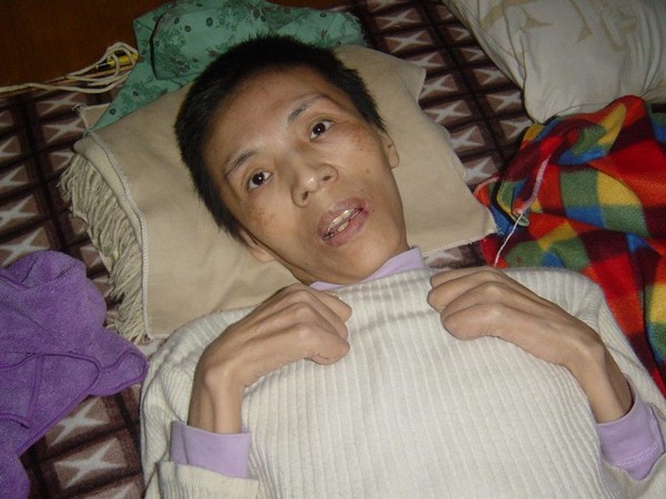 Даи Лицзюань после пыток. Фото с epochtimes.com