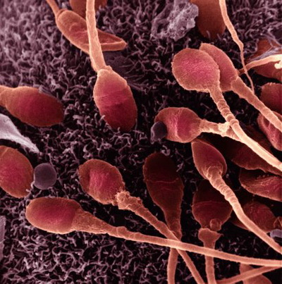 Все сперматозоиды обладают одинаковыми шансами. Фото: Dr. David Phillips/Getty Images