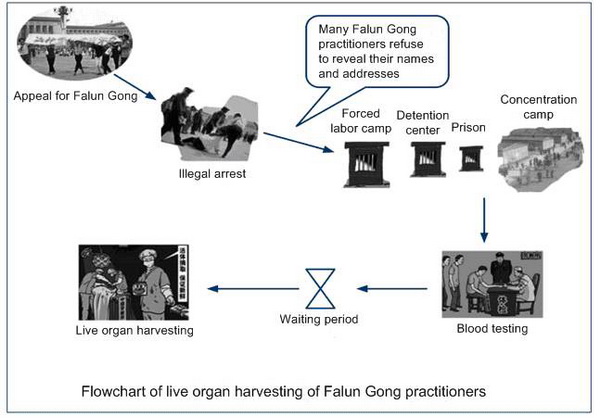 Извлечение живых органов у последователей Фалуньгун.