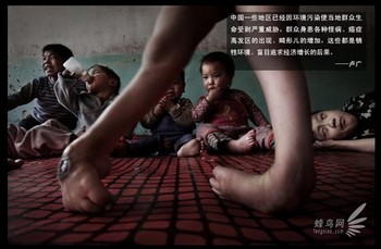 Провинция Шаньси является наиболее загрязнённым районом Китая. В этой провинции также наибольший процент детей с врождёнными дефектами. На фото: крестьянская семья взяла на воспитание 17 детей-инвалидов. 15 апреля 2009 года. Фото: Лу Гуан