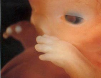 Глаза, руки и пальцы видны более четко. На 8-м месяце беременности. Фото: epochtimes.de