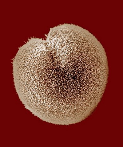 После оплодотворения яйцеклетки и объединения генов яйцеклетки и сперматозоида начинается процесс дробления. Фото: Eric Audras/Getty Images