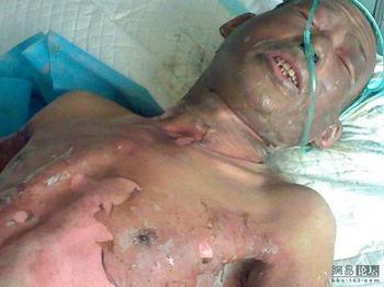 Цзэн Сянган находится в больнице в тяжёлом состоянии. Фото с epochtimes.com