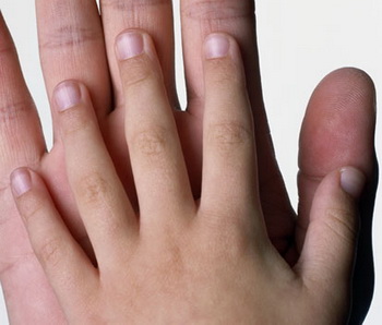 Ногти содержат информацию как минимум за 6 последних месяцев жизни человека, а иногда еще дольше. Фото: Anthony Saint James/Getty Images