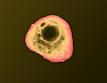 Цитомегаловирус. В экспериментах, поставленных на мышах, инфицирование цитомегаловирусом приводило к повышению артериального давления. Фото: Science VU/Getty Images