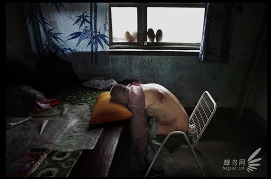 Из-за длительного употребления загрязненной воды, многие жители деревни Сякан провинции Шаньси заболели раком или у них случился тромбоз мозга. На фото 64-летний Ван Баошень. Он заболел в 2003 году. Всё его тело гноится. Фото: epochtimes.com