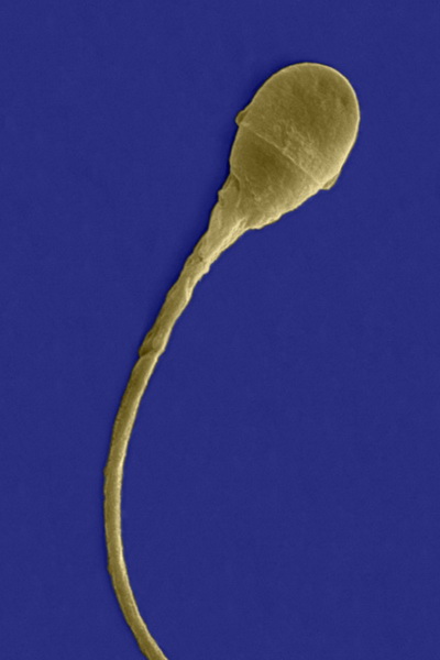 Головка сперматозоида содержит акросому – специфический органоид, в котором имеются специальные ферменты, способствующие растворению оболочки яйцеклетки и проникновению генетического материала сперматозоида внутрь. Фото: Dr. David Phillips/Getty Images